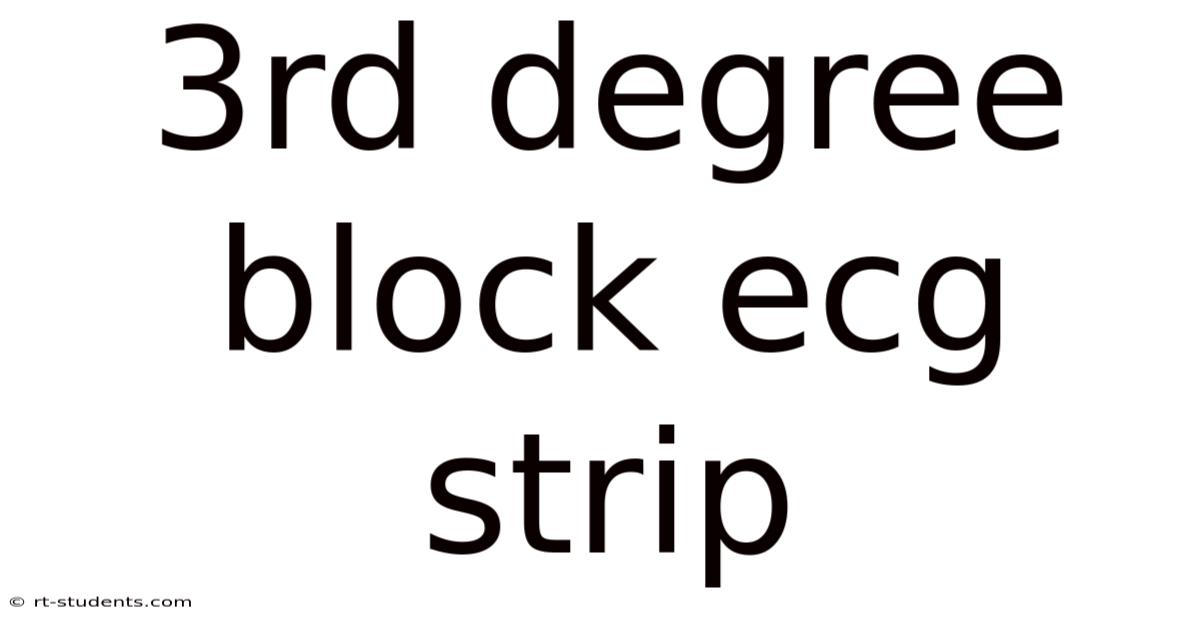 3rd Degree Block Ecg Strip