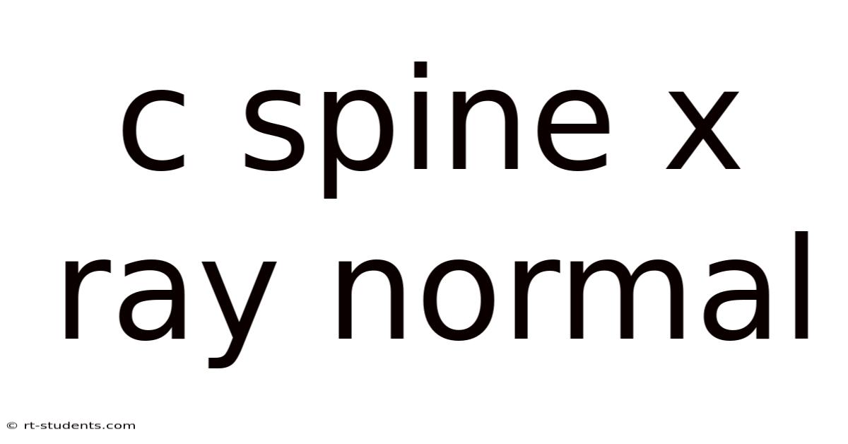 C Spine X Ray Normal