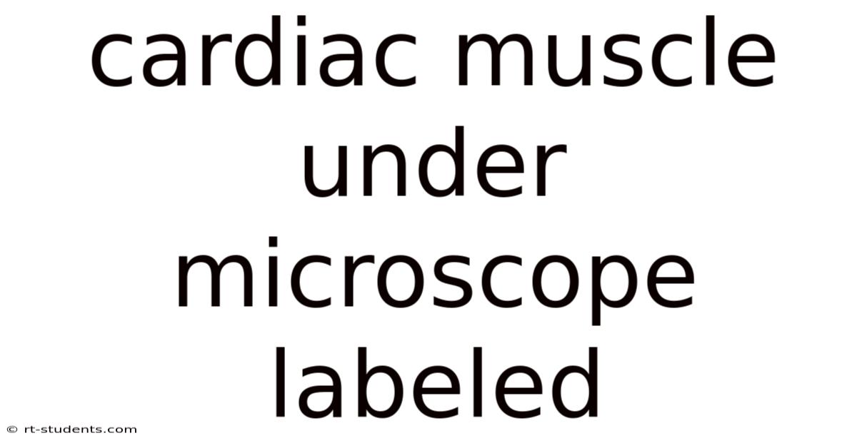 Cardiac Muscle Under Microscope Labeled