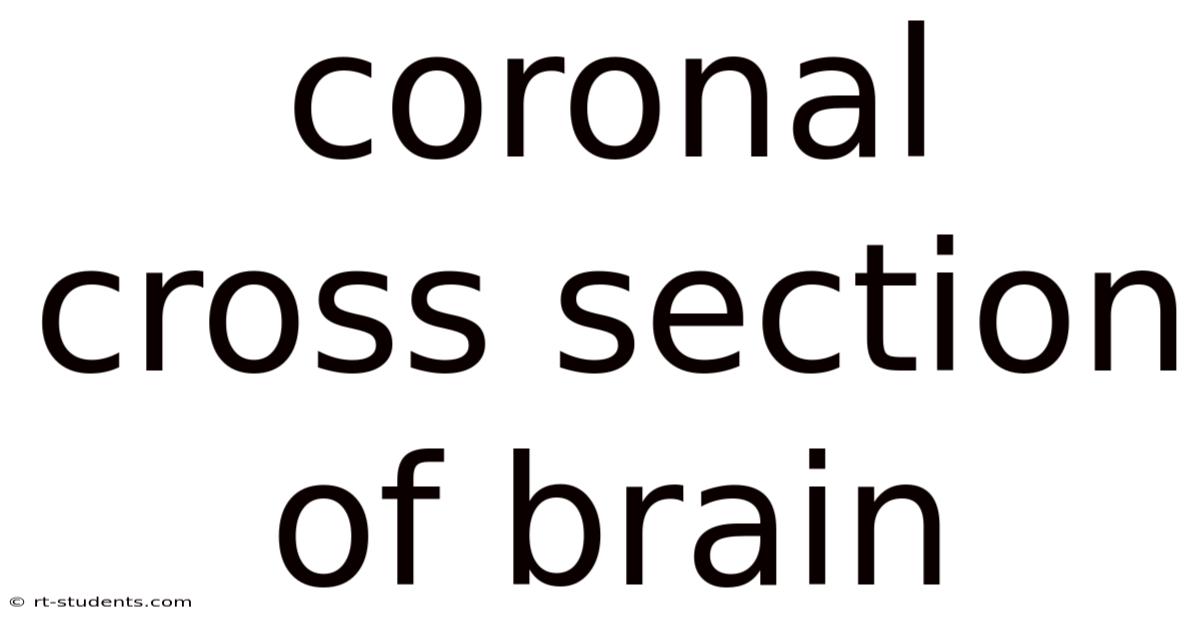Coronal Cross Section Of Brain