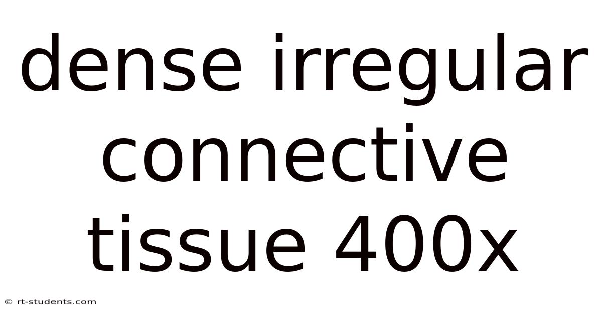 Dense Irregular Connective Tissue 400x