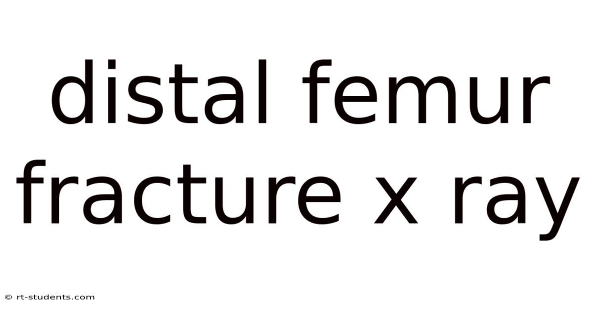 Distal Femur Fracture X Ray