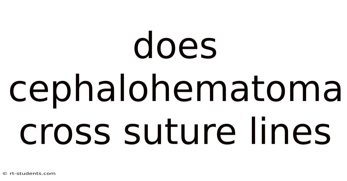 Does Cephalohematoma Cross Suture Lines