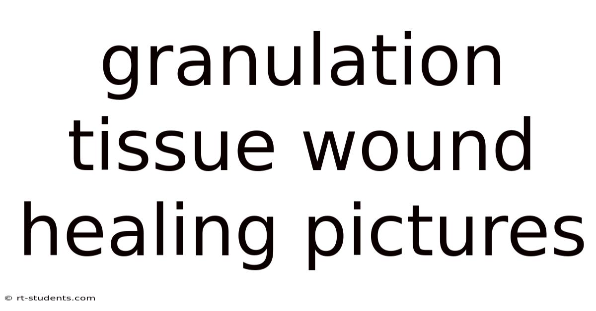 Granulation Tissue Wound Healing Pictures