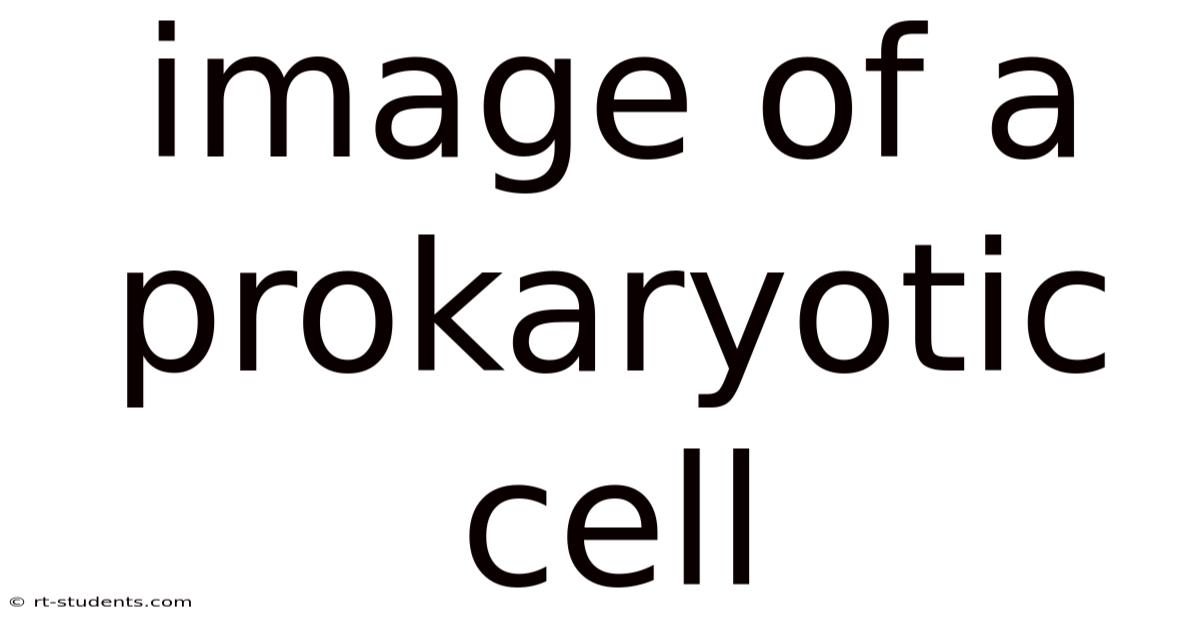 Image Of A Prokaryotic Cell