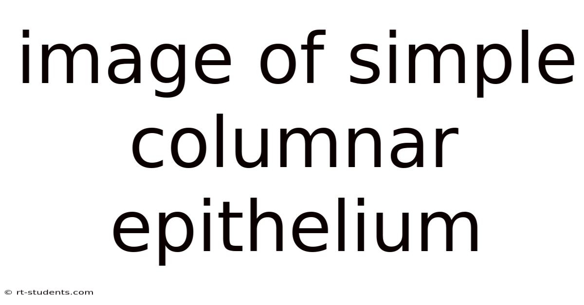 Image Of Simple Columnar Epithelium