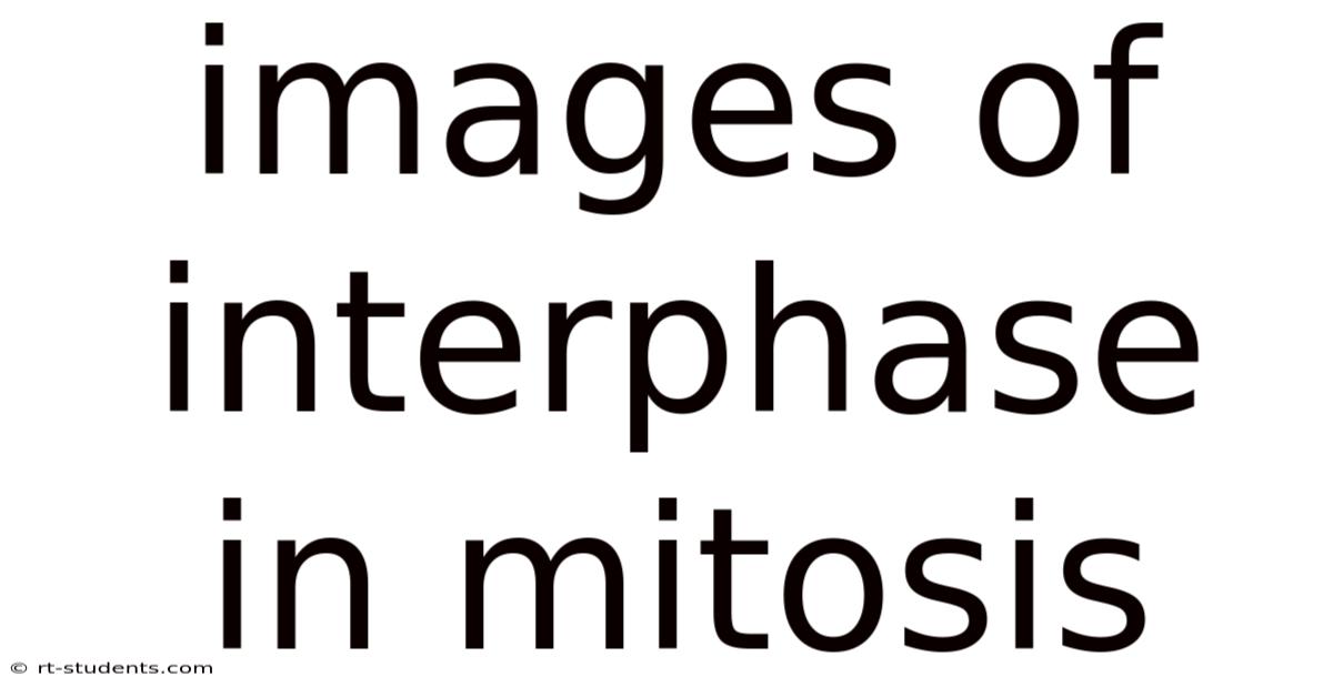 Images Of Interphase In Mitosis