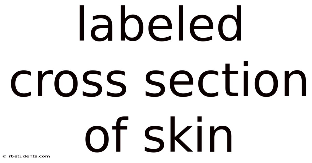 Labeled Cross Section Of Skin