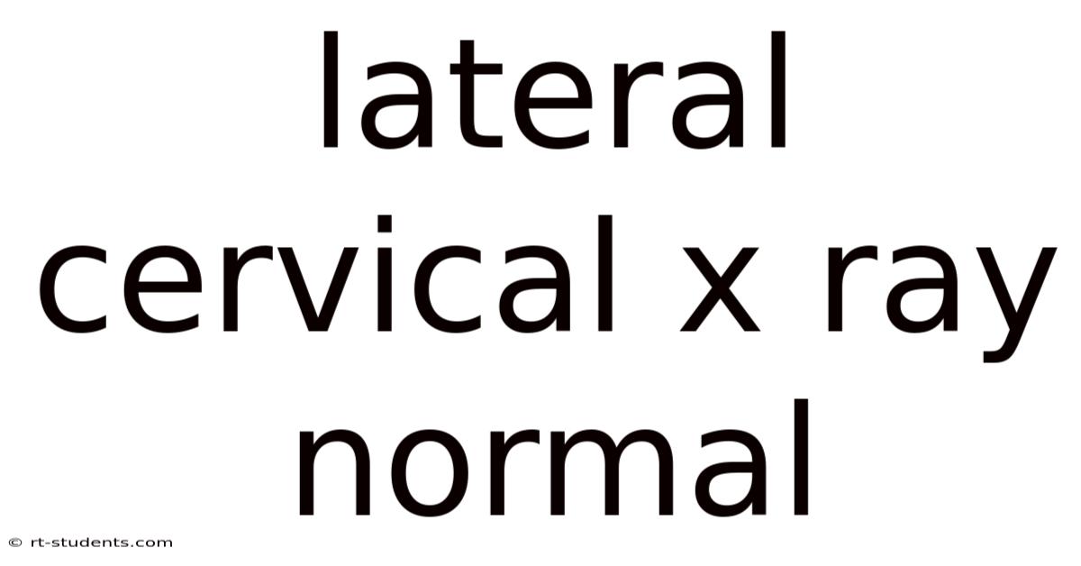 Lateral Cervical X Ray Normal