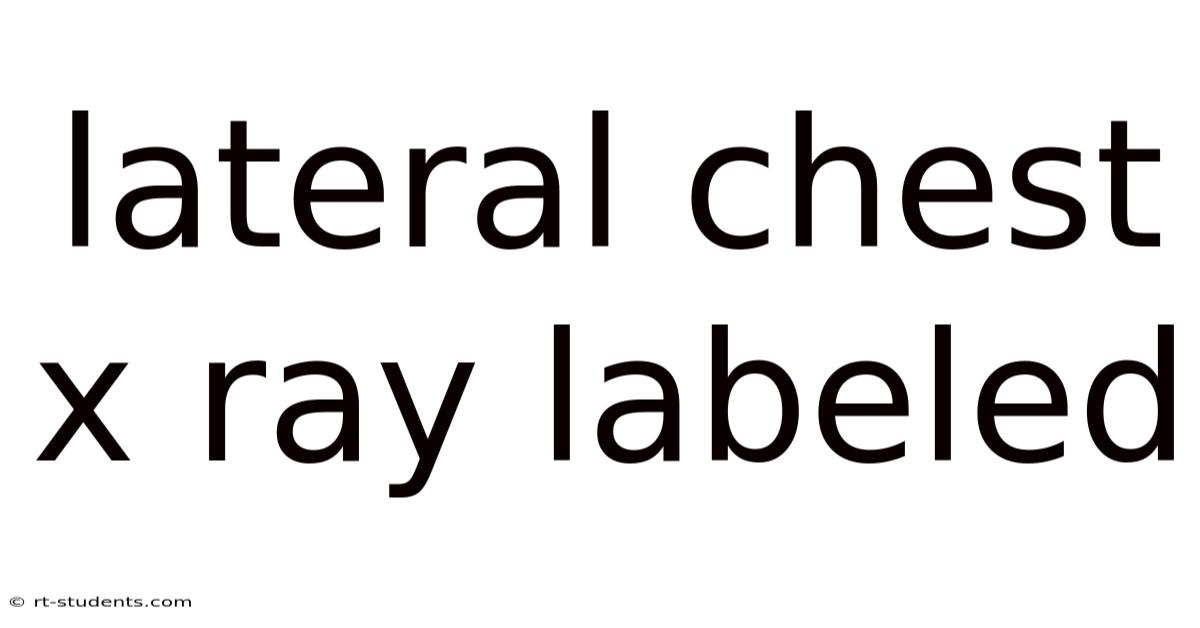 Lateral Chest X Ray Labeled