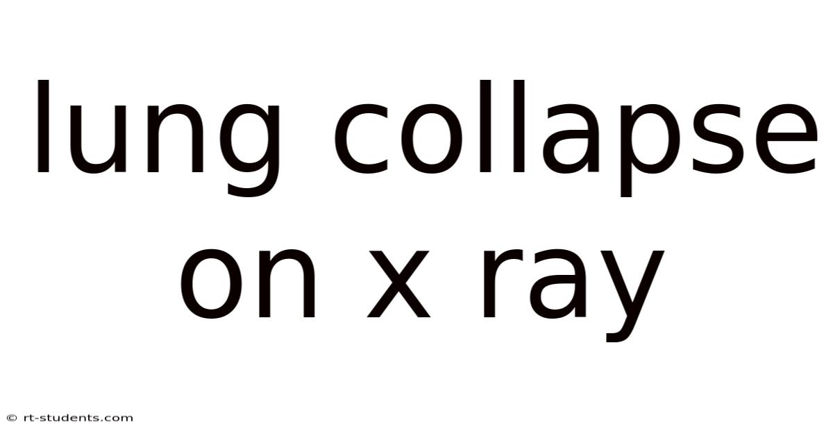Lung Collapse On X Ray