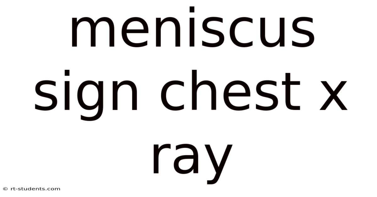 Meniscus Sign Chest X Ray
