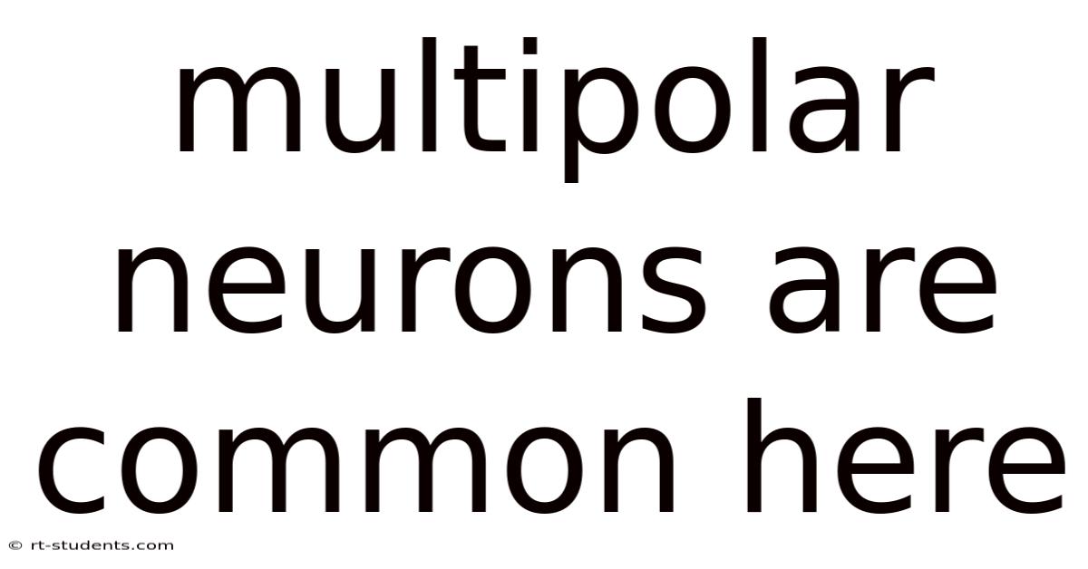 Multipolar Neurons Are Common Here
