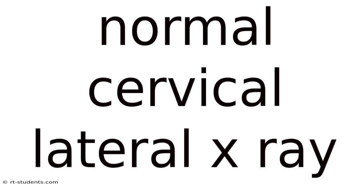 Normal Cervical Lateral X Ray