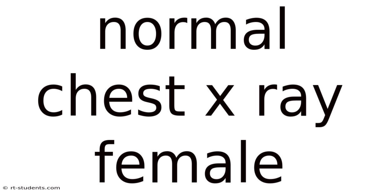 Normal Chest X Ray Female