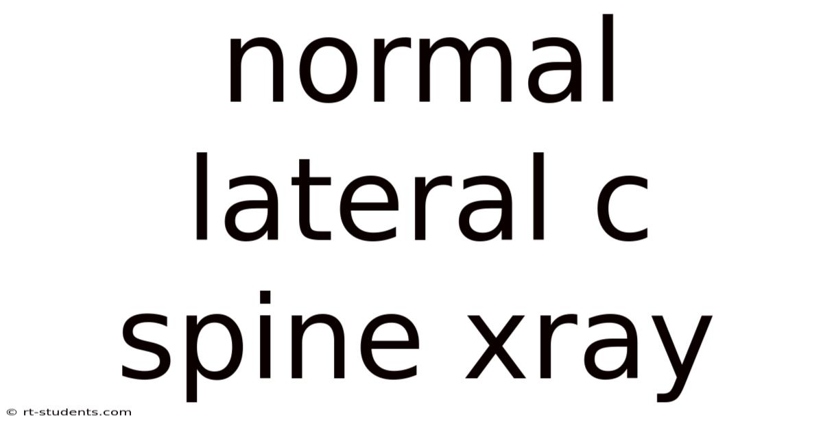 Normal Lateral C Spine Xray