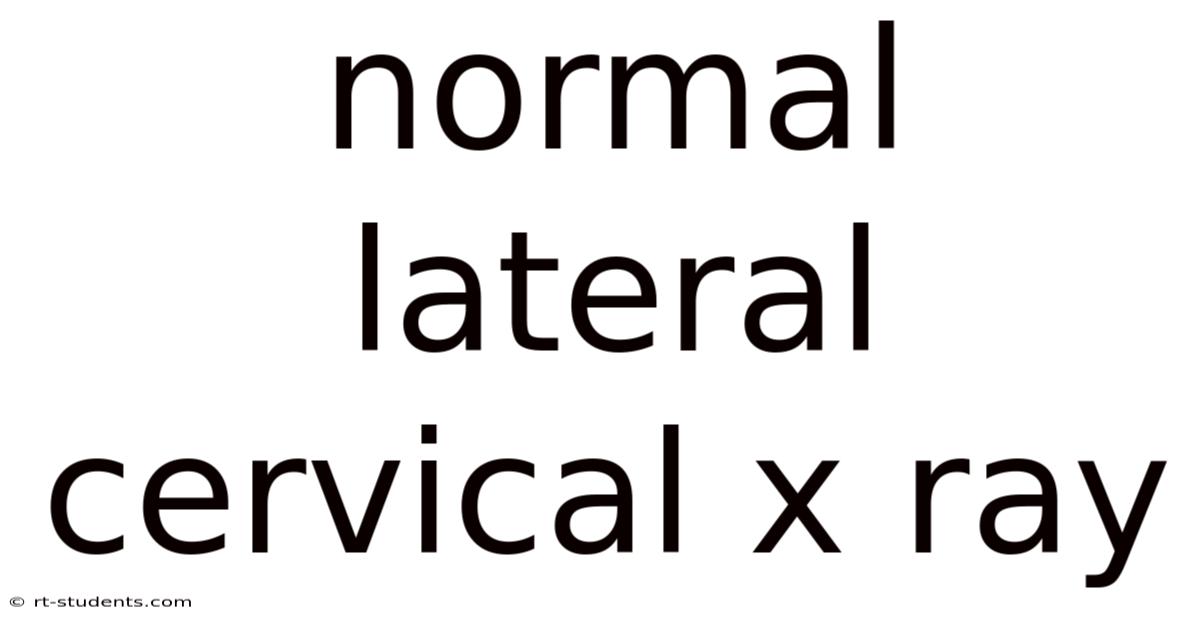 Normal Lateral Cervical X Ray