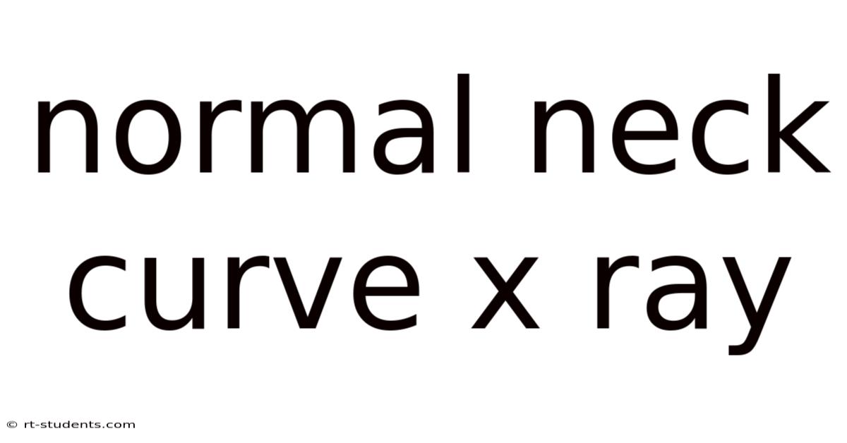 Normal Neck Curve X Ray