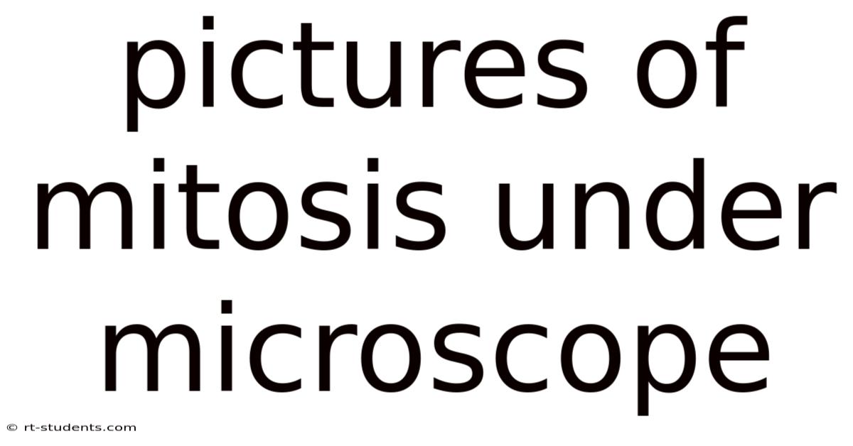 Pictures Of Mitosis Under Microscope