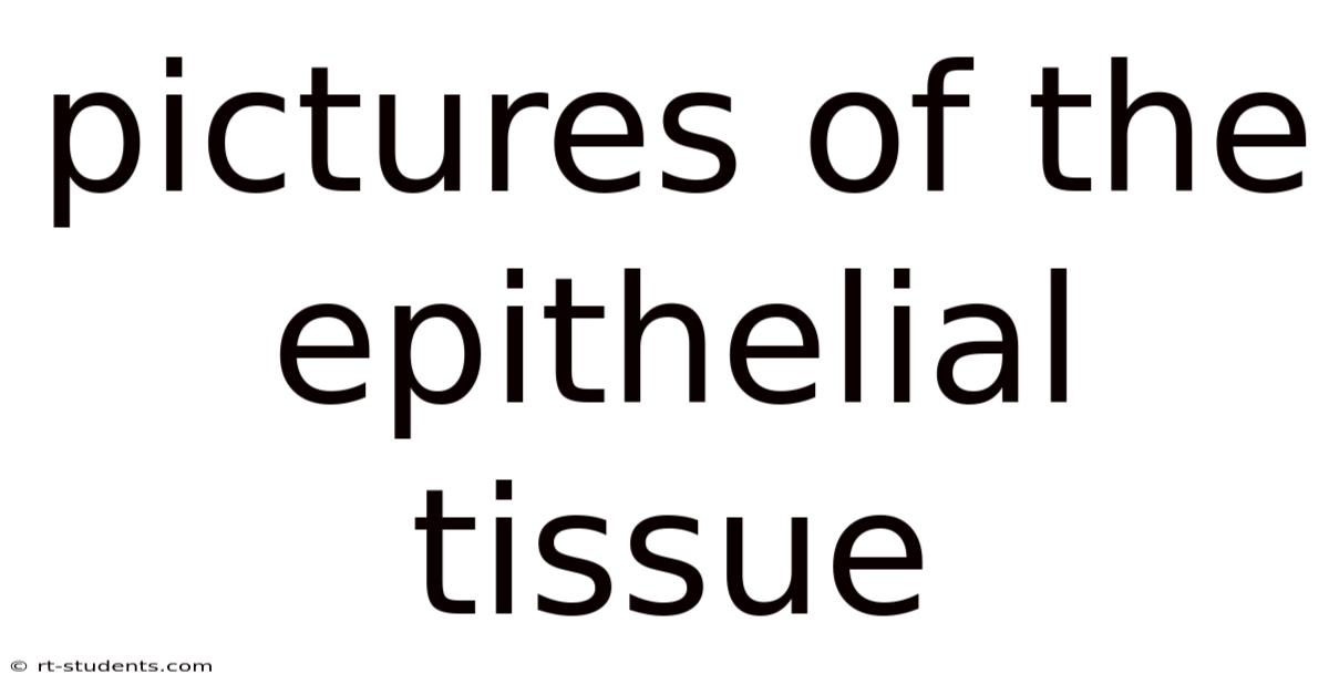 Pictures Of The Epithelial Tissue