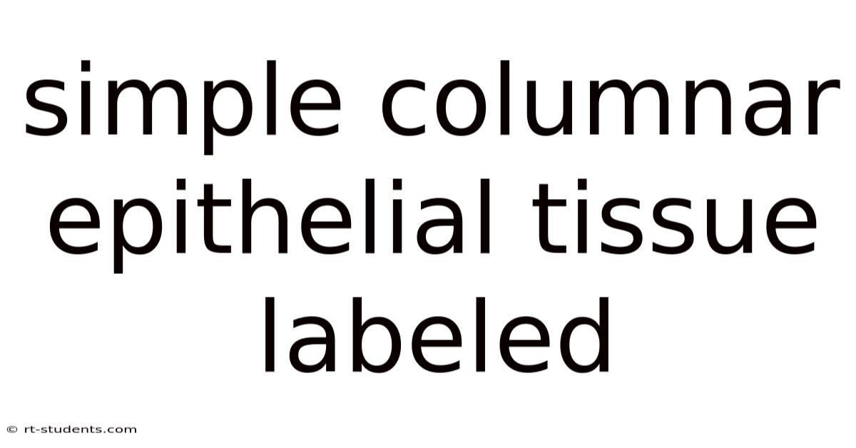 Simple Columnar Epithelial Tissue Labeled