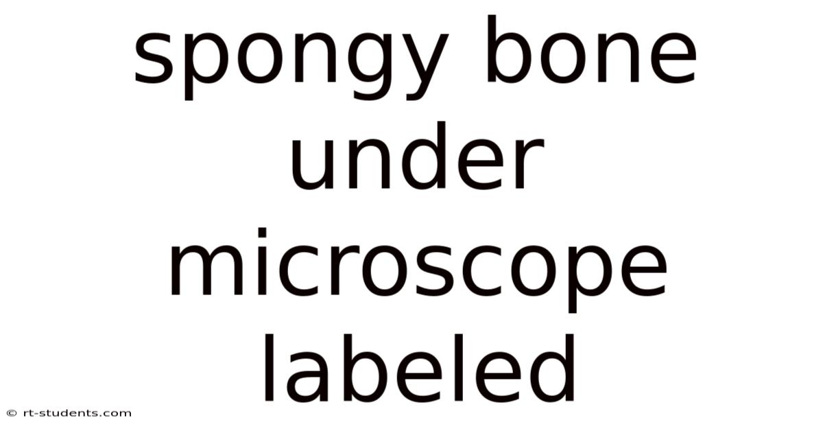 Spongy Bone Under Microscope Labeled