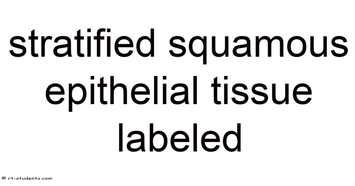 Stratified Squamous Epithelial Tissue Labeled
