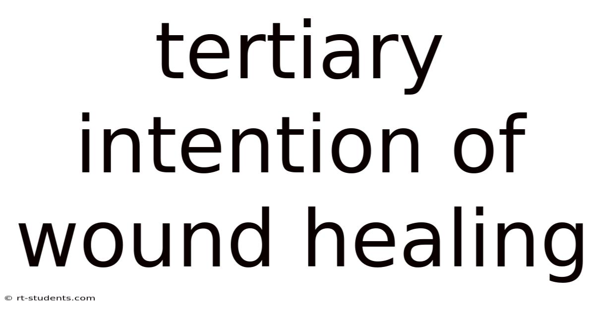 Tertiary Intention Of Wound Healing