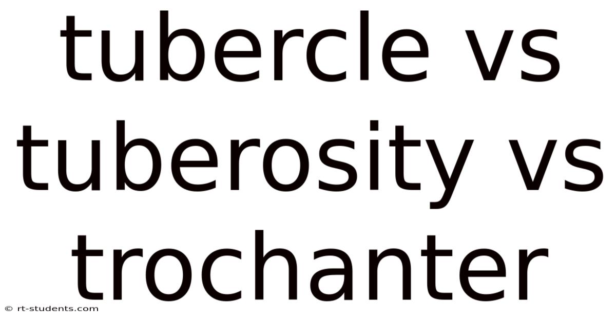 Tubercle Vs Tuberosity Vs Trochanter