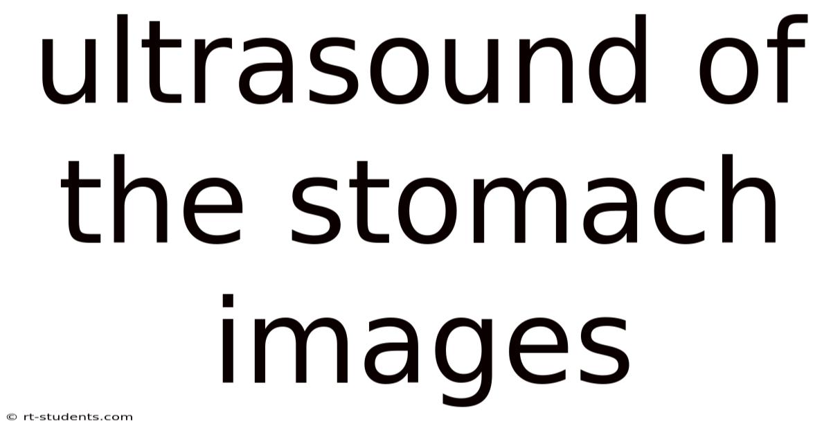 Ultrasound Of The Stomach Images