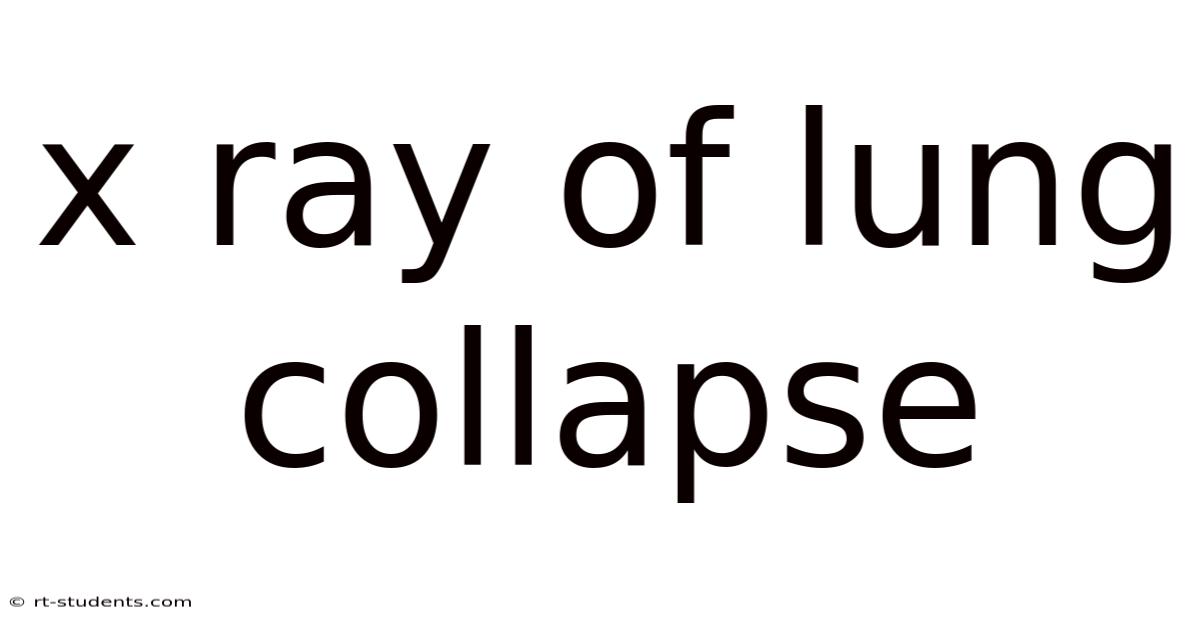 X Ray Of Lung Collapse